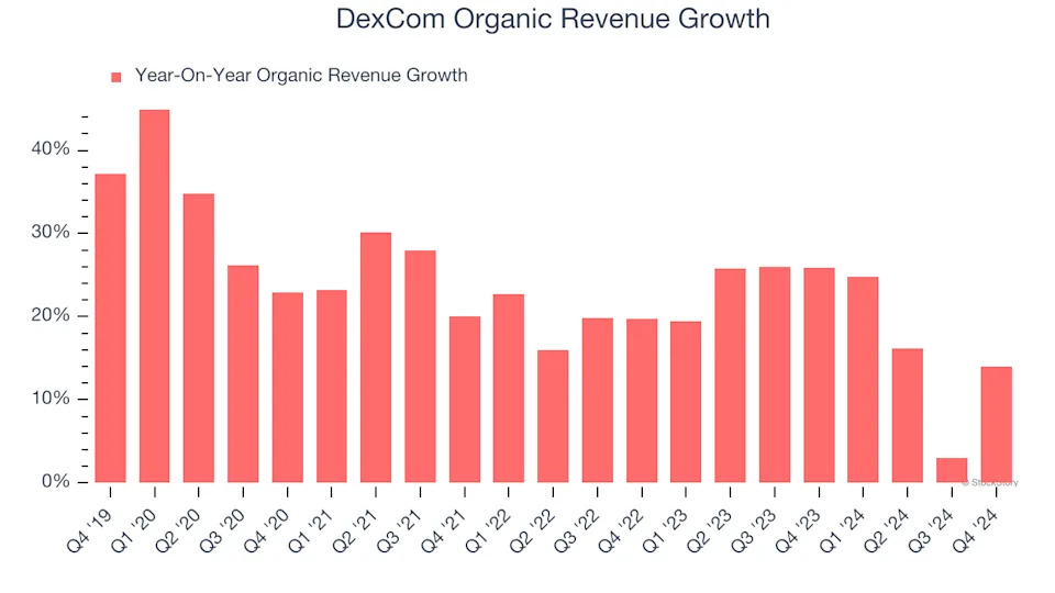 DexCom (DXCM): 3 Reasons We Love This Stock