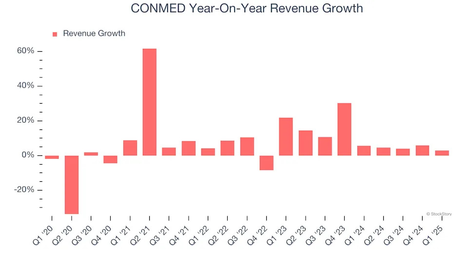 CONMED’s (NYSE:CNMD) Q1 Sales Beat Estimates, Stock Soars