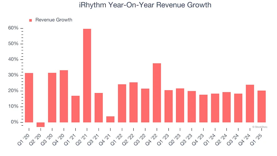 iRhythm (NASDAQ:IRTC) Surprises With Strong Q1, Full-Year Sales Guidance is Optimistic